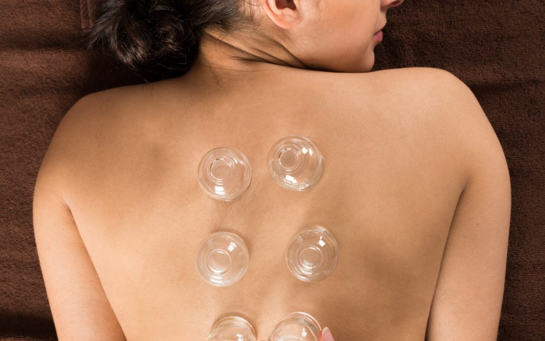 Denise Fürst – Heilpraktikerin, Expertin für Stress & Angst – Denise FürstaDenise Fürst – Heilpraktikerin, Expertin für Stress & Angst – Heilers Werkzeuge – Schröpfen